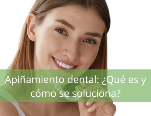 Apiñamiento dental: ¿Qué es y cómo se soluciona?